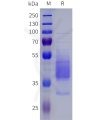 sp-pme101822 npy1r sp1
