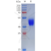 sp-pme101908 drd3 sp1