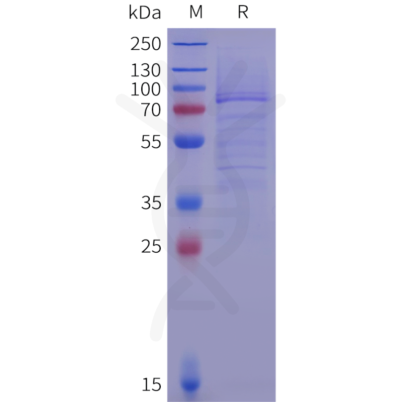 Buy Human APRIL Trimer Protein, hFc Tag-APRIL Recombinant Protein-DIMA ...