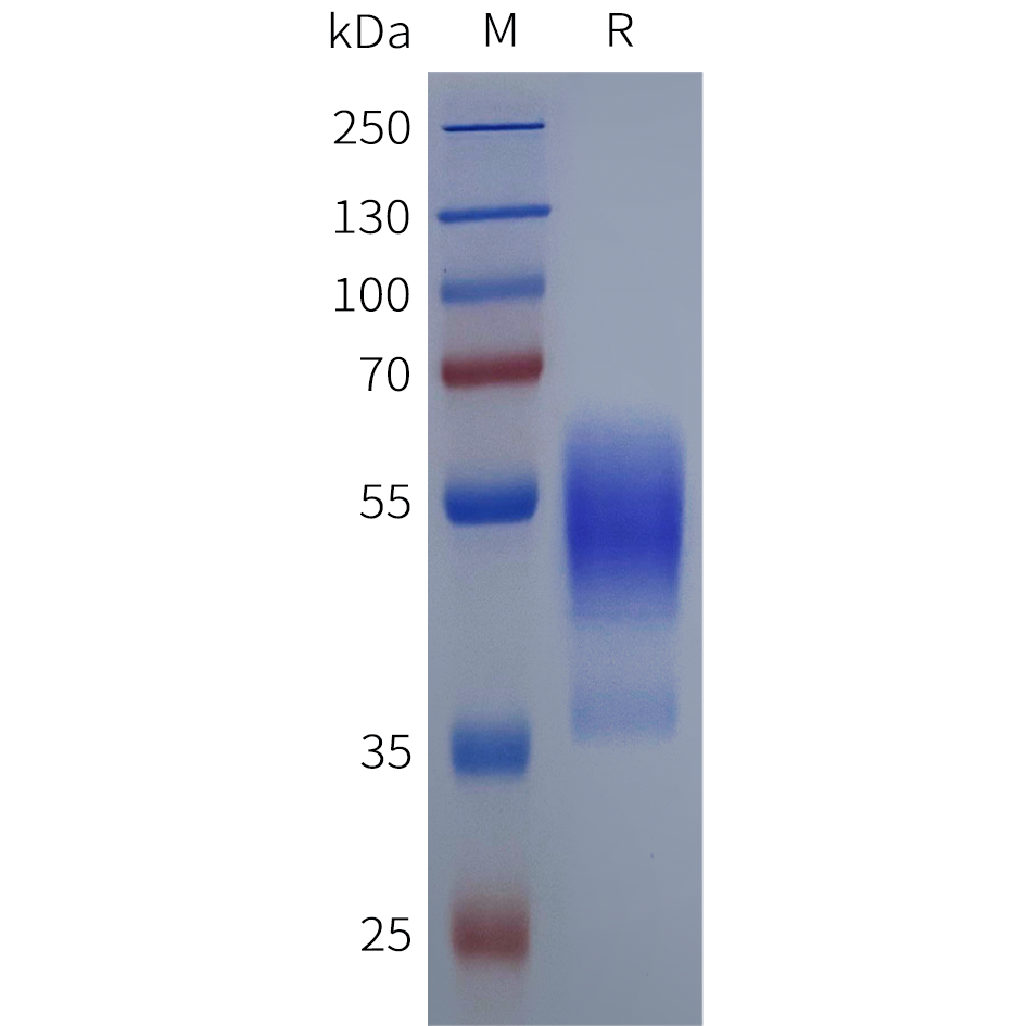 pme102004-cxcr3-sp1.png
