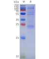 sp-pme102016 il33 sp1