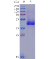 sp-pme102018 il12rb1 sp1