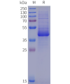 sp-pme102019 il12rb1 sp1