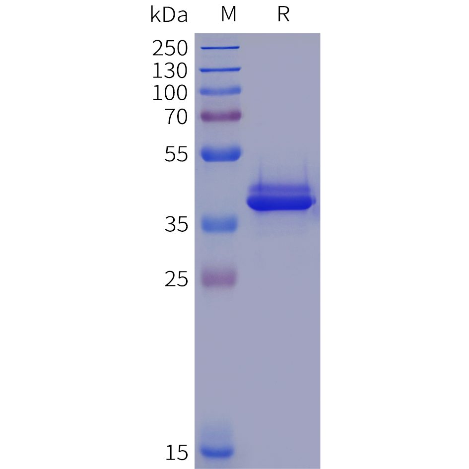 pme102020-il12rb1-sp1.png