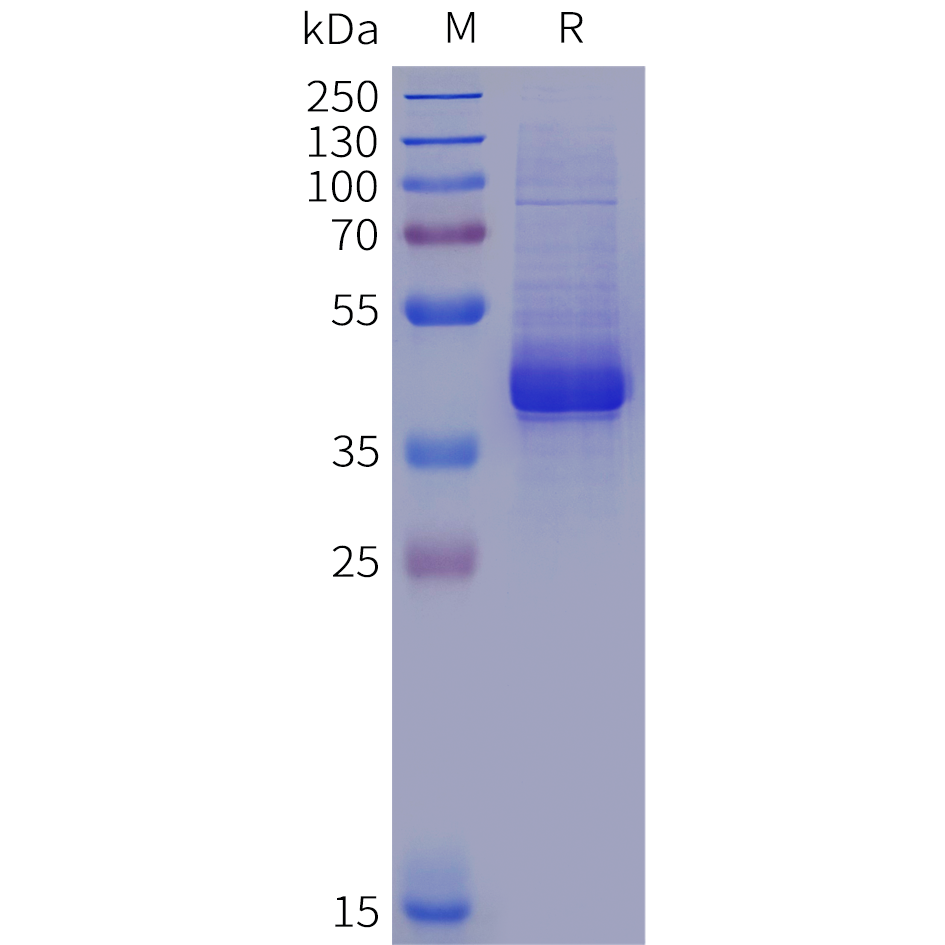 pme102021-il12rb1-sp1.png