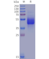 sp-pme102022 il12rb1 sp1