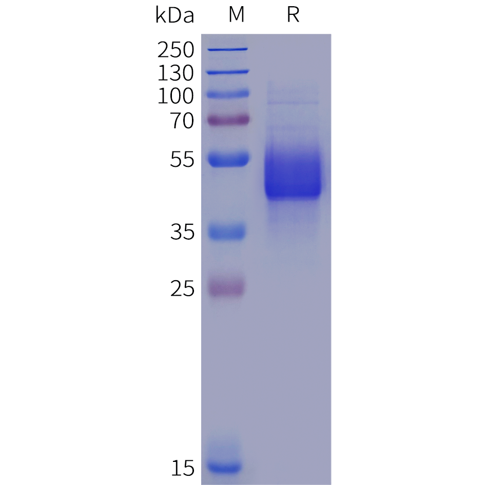 pme102022-il12rb1-sp1.png