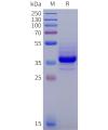 sp-pme102024 il11ra sp1