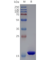 sp-pme102030 sortase a sp1
