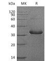 sp-pme30075 igfbp 1 sp1