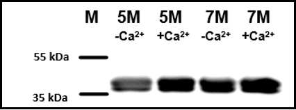 pme102030-sortase-a-wb1.png