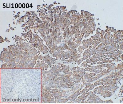 ihc-sli100004 huh7 ihc1