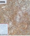 ihc-sli100006 mkn45 ihc1