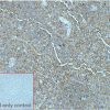ihc-sli100008 daudi ihc1