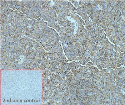 ihc-sli100008 daudi ihc1