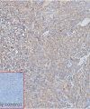 ihc-sli100013 raji ihc1