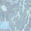 ihc-sli100015 lncap ihc1