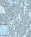 ihc-sli100015 lncap ihc1