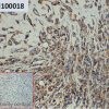 ihc-sli100018 mcf 7 ihc1