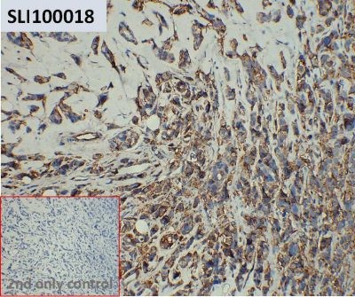 ihc-sli100018 mcf 7 ihc1