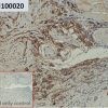 ihc-sli100020 t47 d ihc1