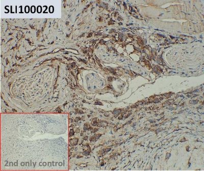 ihc-sli100020 t47 d ihc1