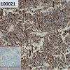 ihc-sli100021 ags ihc1