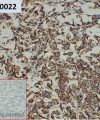 ihc-sli100022 sk br 3 ihc1