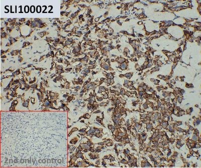 ihc-sli100022 sk br 3 ihc1